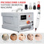Carbon Peel Picosecond Laser Tattoo Removal Machine freckle Pigment Removal Skin Rejuvenation