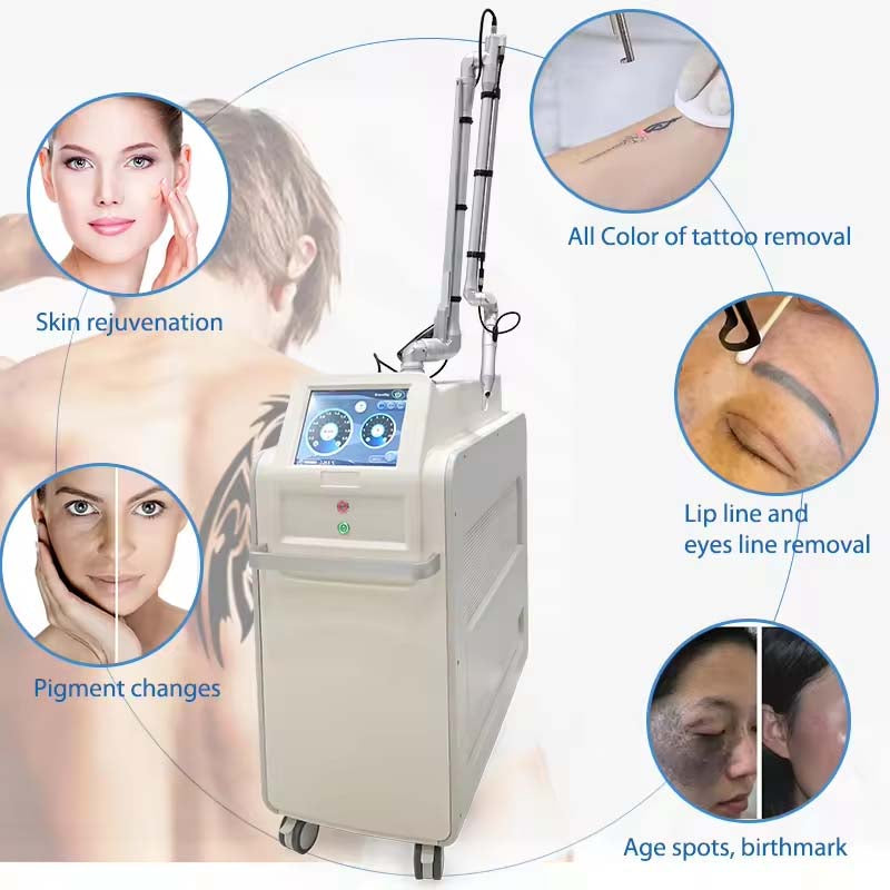 Picosecond Laser Tattoo Removal: A Clinical Guide to 1064nm, 755nm, and 532nm Treatments