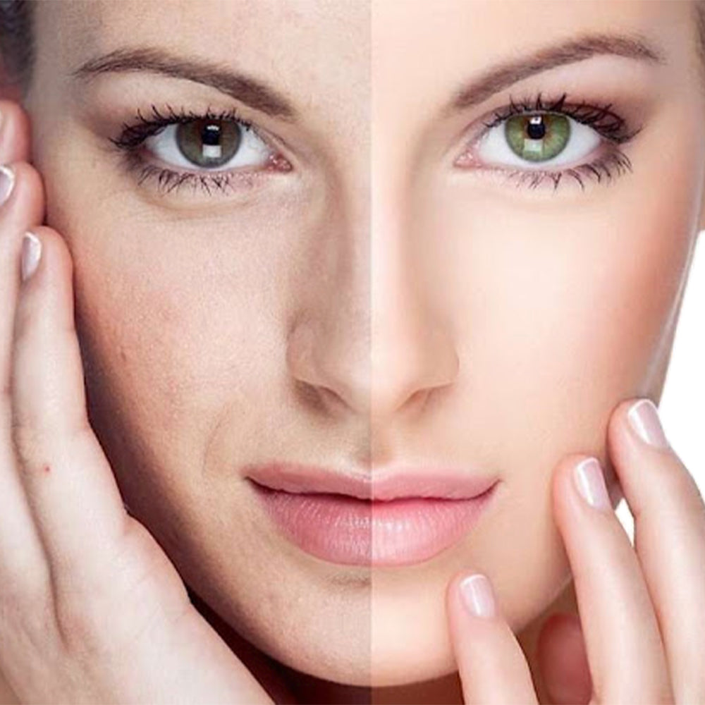 Wrinkle Removal AndSkinTightening