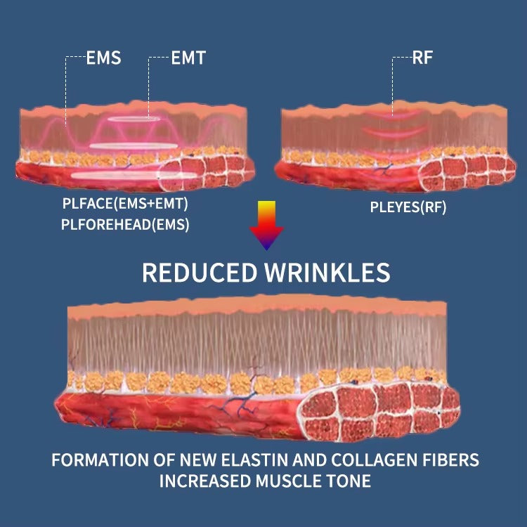 Facial Skin Tightening Magnetic RF PE Face Lifting Muscle Tightening EMS Machine
