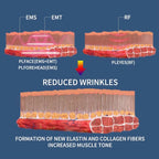 Facial Skin Tightening Magnetic RF PE Face Lifting Muscle Tightening EMS Machine