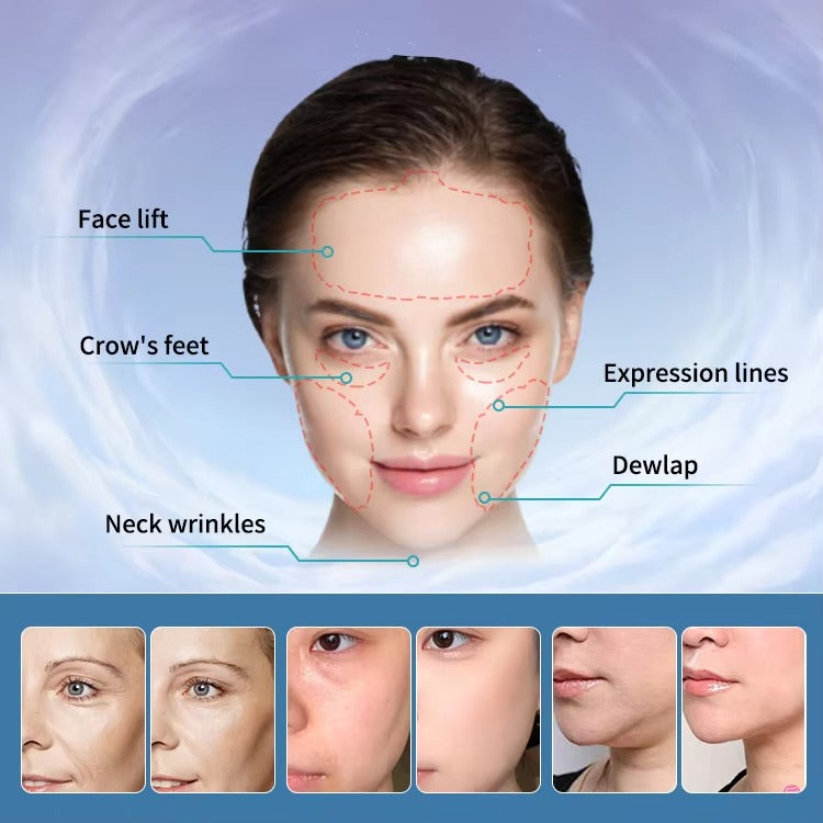 Facial Skin Tightening Magnetic RF PE Face Lifting Muscle Tightening EMS Machine