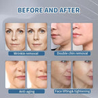 Facial Skin Tightening Magnetic RF PE Face Lifting Muscle Tightening EMS Machine