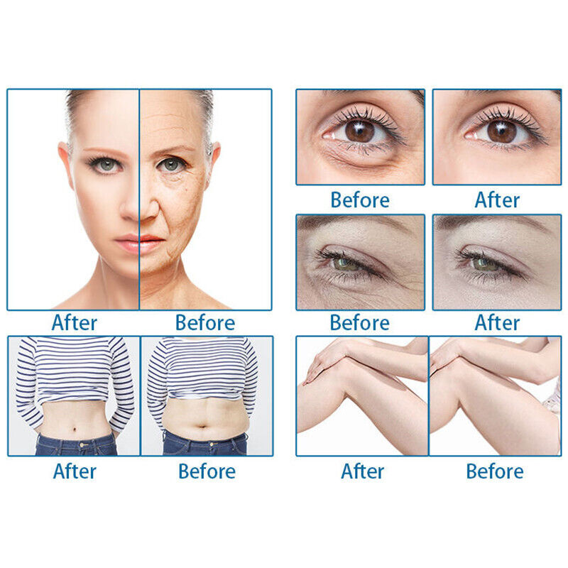 Ultrasonic 2In1 7D Hifu Skin Lifting Vaginal Hifu Machine Tightening Wrinkle Removal Rejuvenation