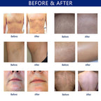 Painless Diode Laser Hair Removal 808/755/1064nm Machine Skin Rejuevantion Summer Hot Beauty