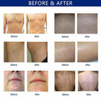 808nm Diode Laser Hair Removal Picosecond Tattoo Removal Skin Care Machine Women