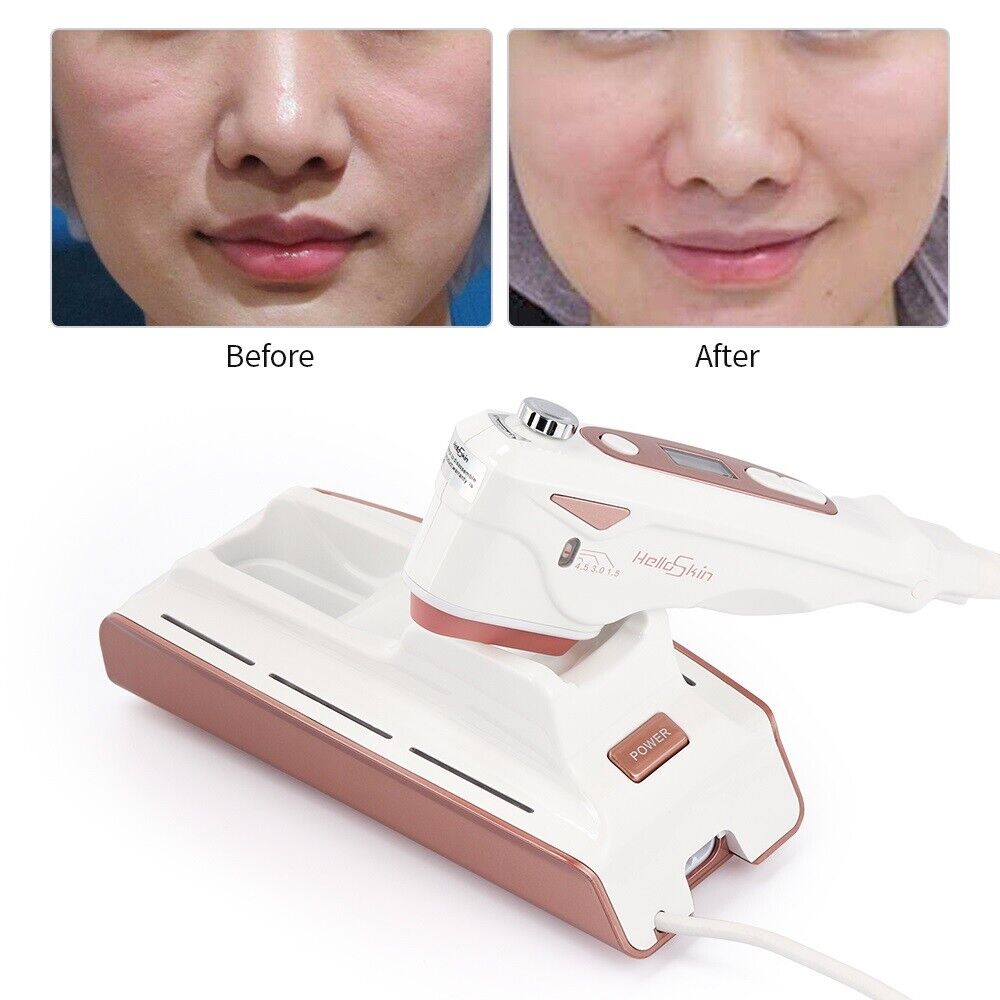 Handheld Ultrasonic HIFU Skin Machine Radio Rejuvenation Face Lifting Anti-aging Imagen secundaria del producto