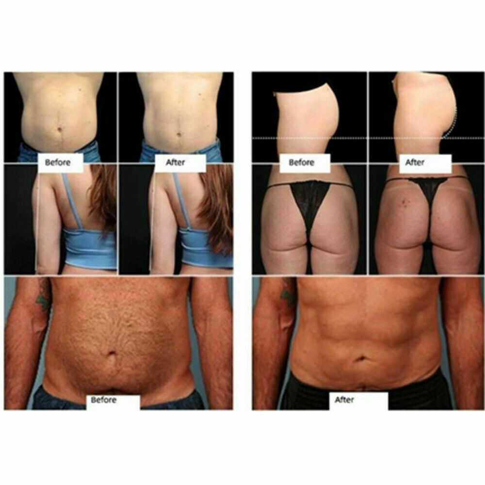 Body Contouring Sculpting Muscle Training Stimulator Slimming Machine Cellulite Reduce