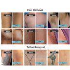 808nm Diode Laser Hair Removal Picosecond Tattoo Removal Skin Care Machine Women