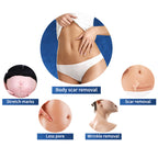 7d Hifu +Vaginal +VMAX + RF Fractional Microneedle Machine  Skin Tightening Face Lifting