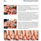 980nm Diode Laser Vascular Blood Removal Spider Vein Physical Therapy Machine