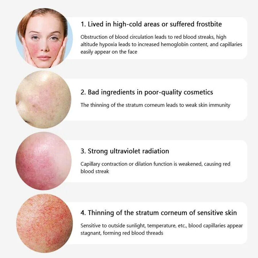 980nm Diode Laser Vascular Blood Removal Spider Vein Physical Therapy Machine