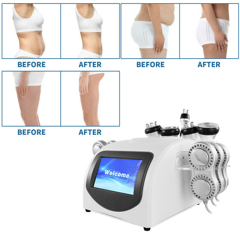 40K Cavitation Body Slimming Machine Vacuum Radio Frequency Skin Care Fat Removal
