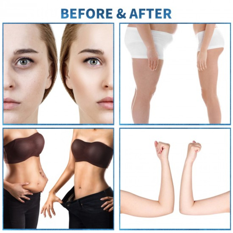 B0154 Professional Cellulite Reduction Inner Ball Roller Fat Removal Beauty Massage Machine