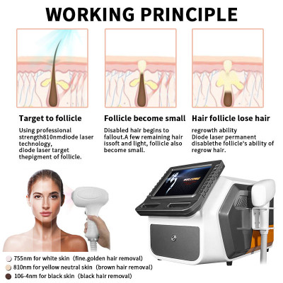 A0416  Crystal flawlessly legs hair remover appliances 810nm dide laser hair removal machine (handle with control screen) A0416  Crystal flawlessly legs hair remover appliances 810nm dide laser hair removal machine (handle with control screen)