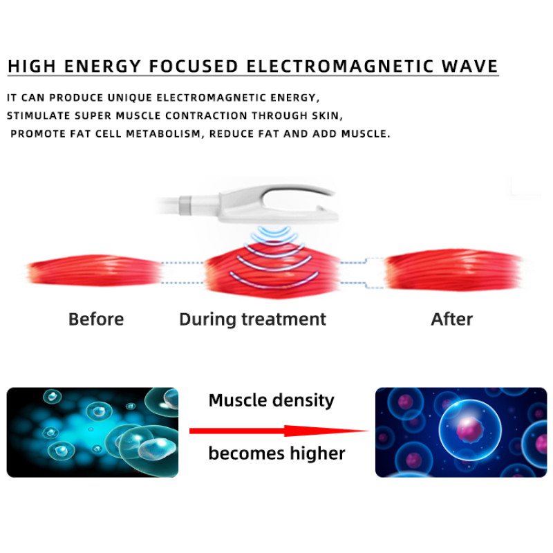 A0241C Portable Emslim 4 Handle Ems RF Neo Emslim Machine / Portable Ems Body Sculpting Machine