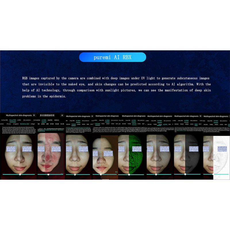 J0108 2023 New Portable 3d AI Wood Lamp Skin Detector Tester Analyzer Reveal Facial Scanner Face Camera Visia Skin Analysis Machine