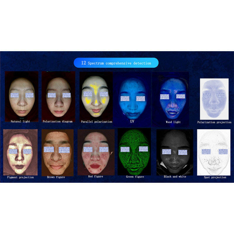 J0108 2023 New Portable 3d AI Wood Lamp Skin Detector Tester Analyzer Reveal Facial Scanner Face Camera Visia Skin Analysis Machine