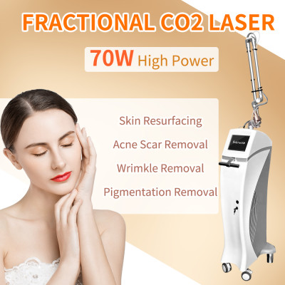 A0528 New Beauty Trends Medical Fractional Co2 Laser System Laser Co2 Fraccionado Portatil Vaginal Y Corporal For Vaginal Tightening A0528 New Beauty Trends Medical Fractional Co2 Laser System Laser Co2 Fraccionado Portatil Vaginal Y Corporal For Vaginal Tightening